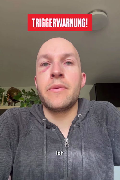 Leopold trägt eine graue Strickjacke, hat ein blaues Auge und blickt ernst in die Kamera. Als Überschrift in rot: Triggerwarnung.